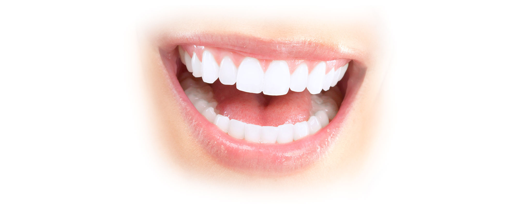 Veneers kieferorthopädische Ordination Zahnzauber in Wien