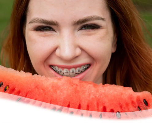 Was kann man mit Zahnspangen gefahrlos essen und was nicht?