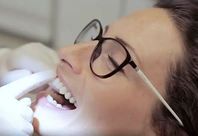 Die Gaumennahterweiterungs-Apparatur: Aufbau und Funktionsprinzip