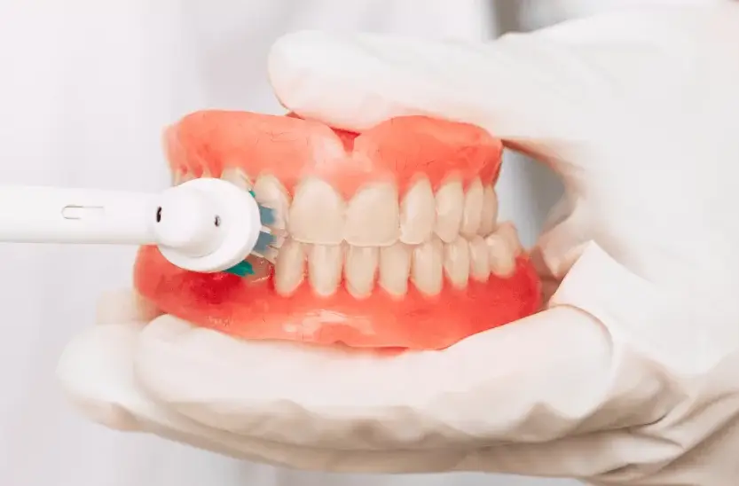 Mundhygiene bei Gaumennahterweiterung mit Metallbändern und Schraube.